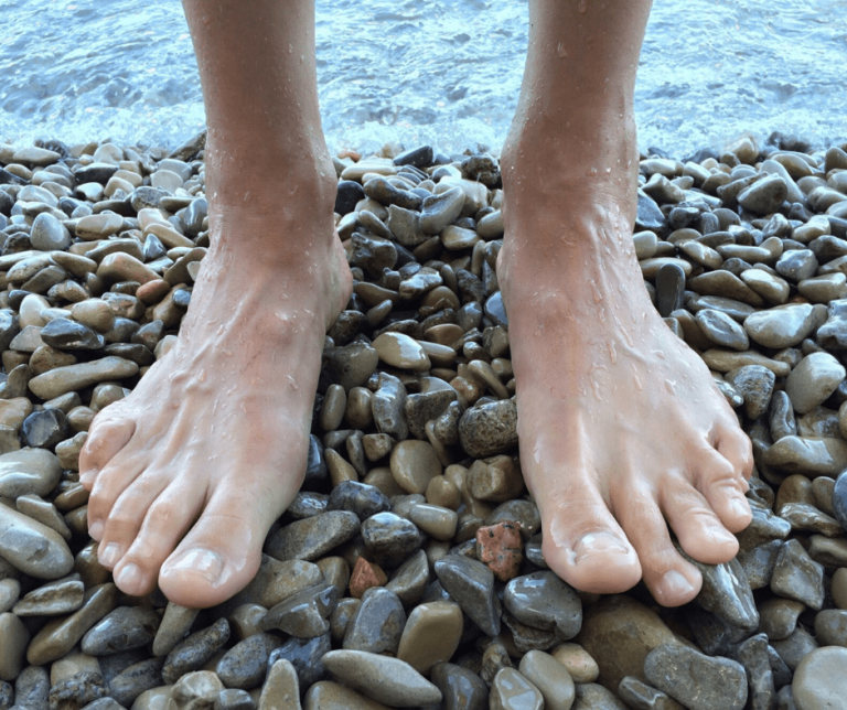 Keep Feet and Ankles Healthy This Summer