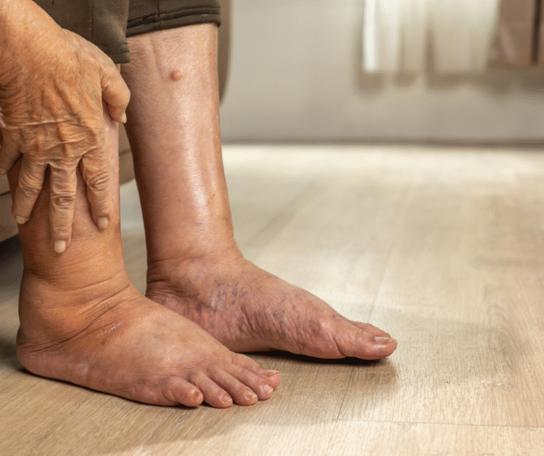 4 Common Skin Conditions Seniors Find on Their Feet