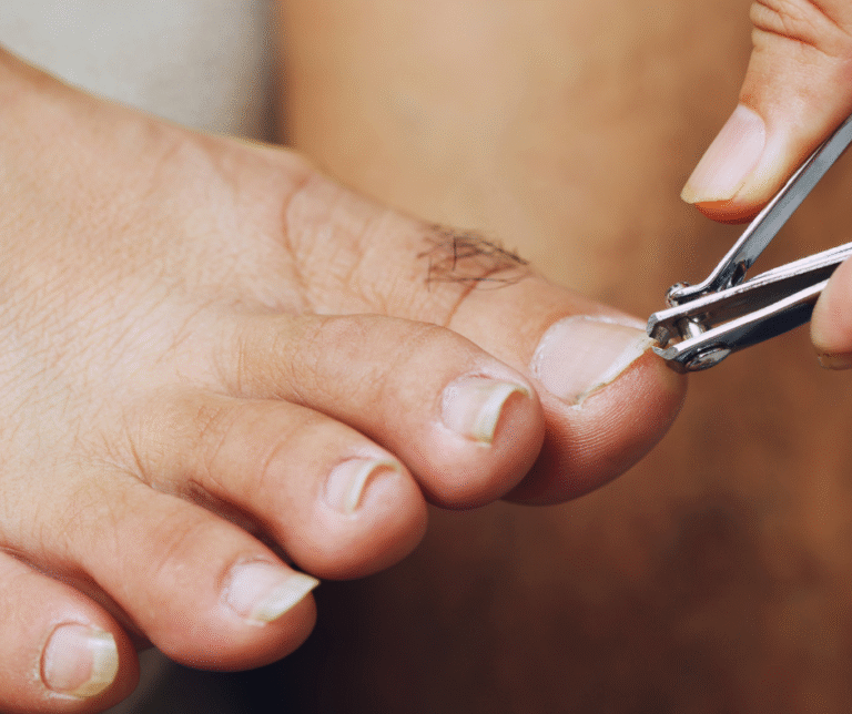What Runners Can Do About 3 Common Toenail Problems