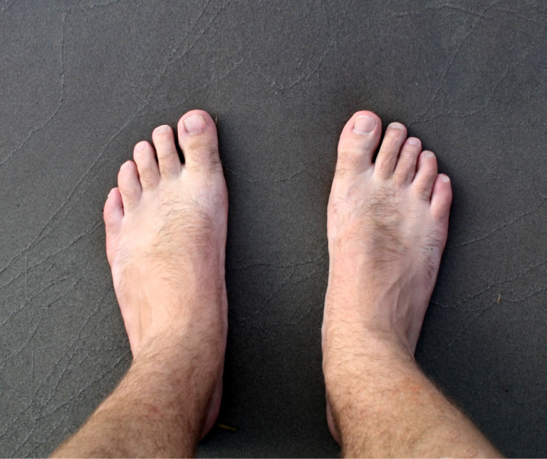 3 Simple Foot Problems Podiatrists Can Easily Treat